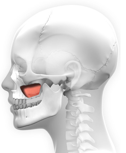 Comblement de sinus : étape 1)