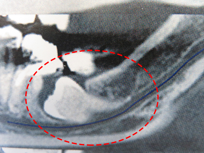 dentoscanner